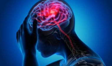 মাইগ্রেনের ৭ অজানা কারণ যা অনেকেই জানেন না