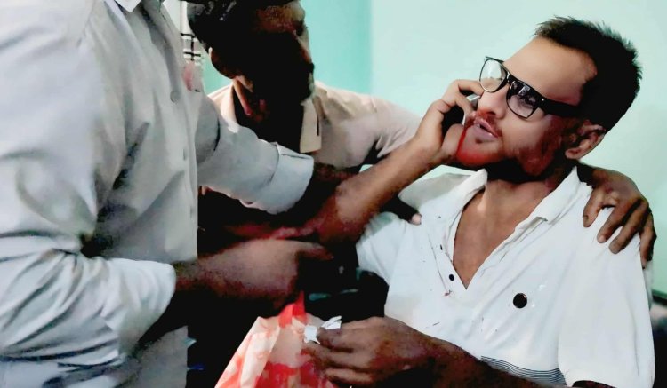 মুজিবনগরে ইউপি সদস্যের ঘুষিতে অপর সদস্য রক্তাক্ত জখম